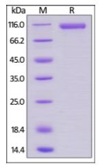 Human MCAM, Fc Tag on SDS-PAGE under reducing (R) condition. The gel was stained overnight with Coomassie Blue. The purity of the protein is greater than 95%.